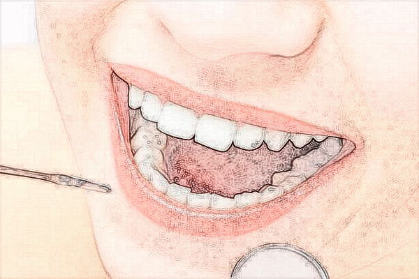 佛山市禪城區(qū)中心醫(yī)院種牙好不好?種牙的好處與危害