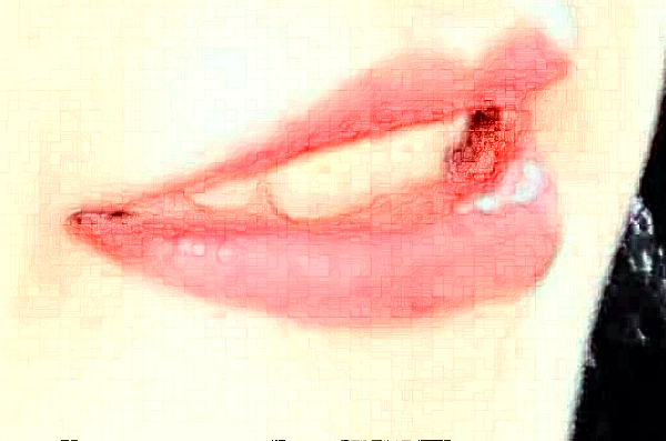 2024大連新華醫(yī)院口腔科全口牙修復(fù)價(jià)格表_醫(yī)生推薦