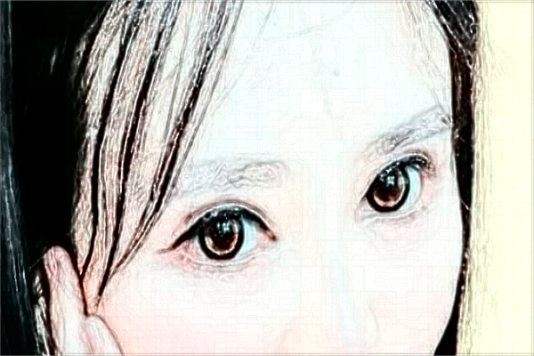 2024江蘇大學(xué)附屬醫(yī)院祛痣做的好嗎_體驗分享