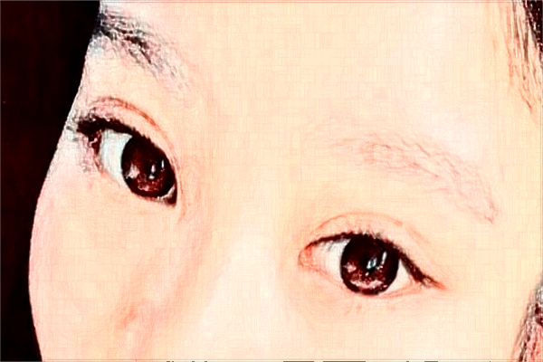 河北省人民醫(yī)院光子嫩膚M22費(fèi)用多少_醫(yī)生名單