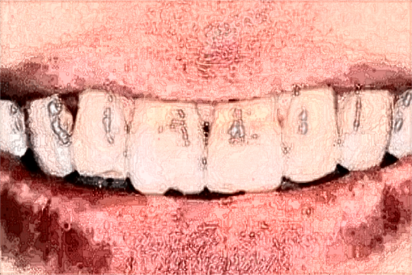 貴陽市婦幼保健院口腔科主任好嗎?口腔科醫(yī)生技術怎么樣?