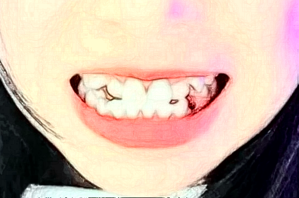 2024天津醫(yī)科大學(xué)第二醫(yī)院口腔科牙體牙髓怎么樣_誰做得好