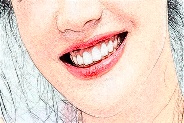 2024安徽省立醫(yī)院烤瓷牙怎么樣_誰做得好