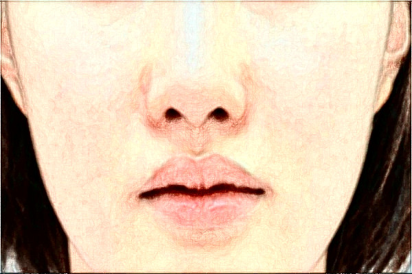 2024河北省人民醫(yī)院激光祛斑做的好嗎?整形日記分享