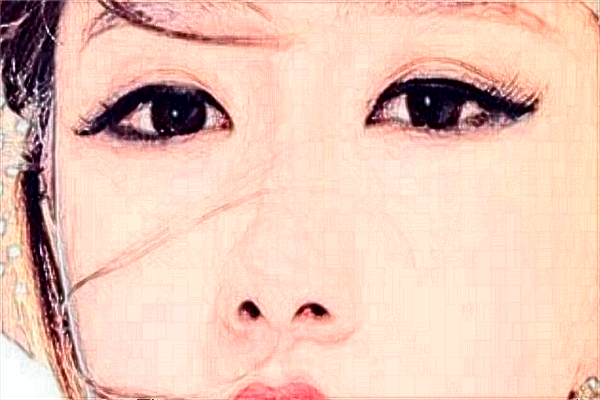 天津醫(yī)科大學(xué)總醫(yī)院全飛秒做的怎么樣_哪位醫(yī)生技術(shù)比較好