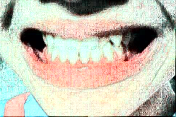 無錫市第一人民醫(yī)院口腔科種植牙做的怎么樣_誰做的比較好