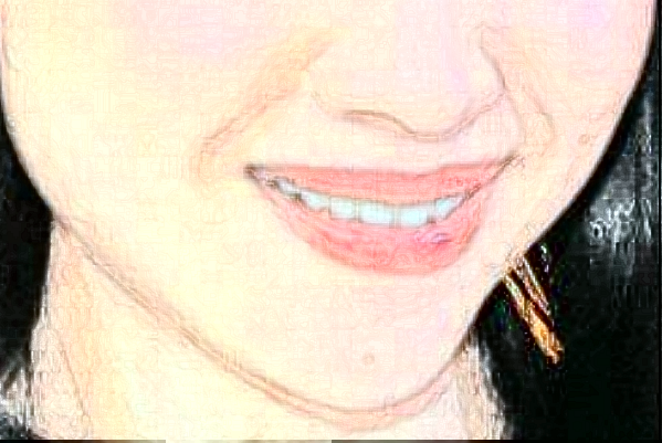 2024哈爾濱242醫(yī)院口腔科拔智齒多少錢？拔智齒日記展示