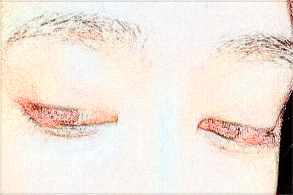 2024南京鼓樓醫(yī)院近視眼手術(shù)多少錢?醫(yī)生名單推薦 