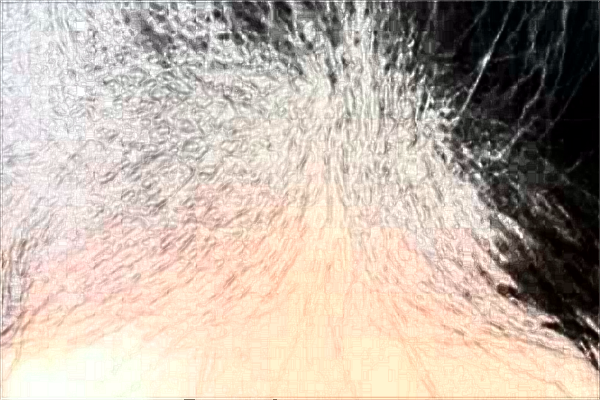 南通大學(xué)附屬醫(yī)院植發(fā)做的好嗎？誰做的好