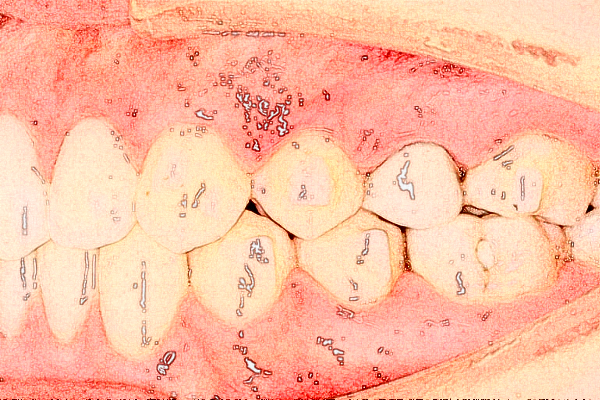 蘇州大學(xué)附屬兒童醫(yī)院口腔科正畸價目表(價格表)怎么樣