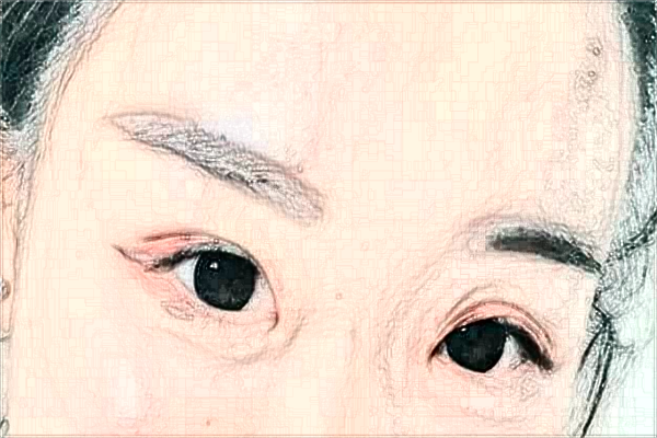 2024天津市醫(yī)科大學(xué)眼科醫(yī)院半飛秒價(jià)格多少?做的怎么樣