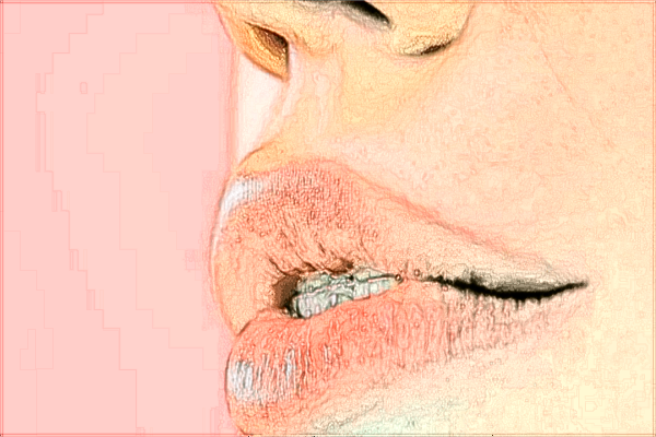 中山大學(xué)附屬第三醫(yī)院矯正視力怎么樣?2024矯正視力手術(shù)多少錢