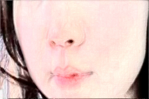 2024揚州市第一人民醫(yī)院激光祛斑怎么樣?全新案例分享