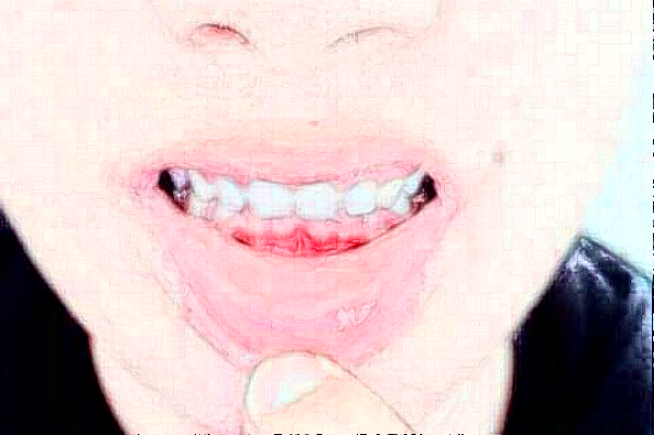 江蘇大學附屬醫(yī)院口腔科錯牙合畸形矯正怎么樣_專家名單