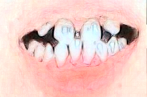 天津醫(yī)科大學(xué)第二醫(yī)院口腔科隱形正畸怎么樣_醫(yī)生排名