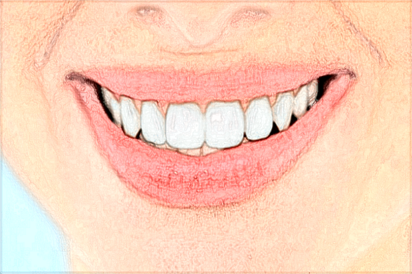 青島海慈醫(yī)院種牙怎么樣?種牙需要多長時間呢