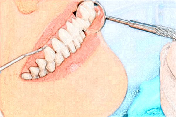 青島市立醫(yī)院牙科水平好嗎?2024牙科收費價格貴嗎