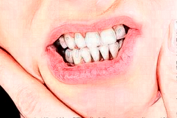 2024揚州市第一人民醫(yī)院全瓷牙做的好不好?醫(yī)生排名