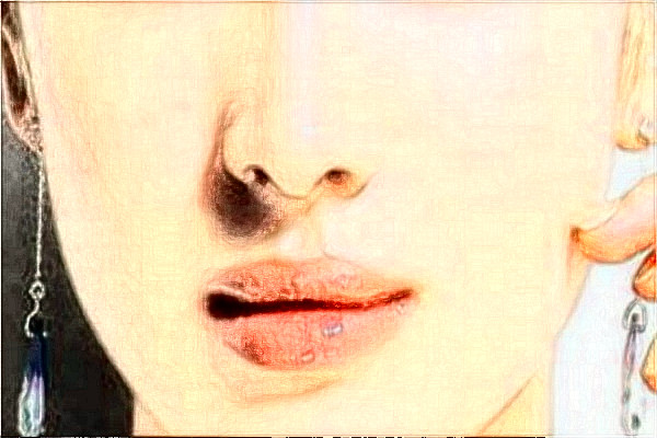 2024天津醫(yī)科大學(xué)總醫(yī)院可以去胎記嗎？去胎記真實案例