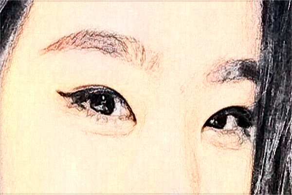 天津醫(yī)科大學(xué)總醫(yī)院光子嫩膚價(jià)格多少?光子嫩膚案例分享