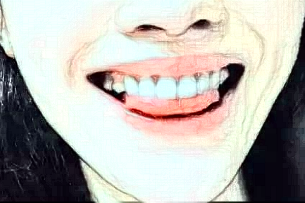 南京中大醫(yī)院種植牙做的好不好?醫(yī)生排名