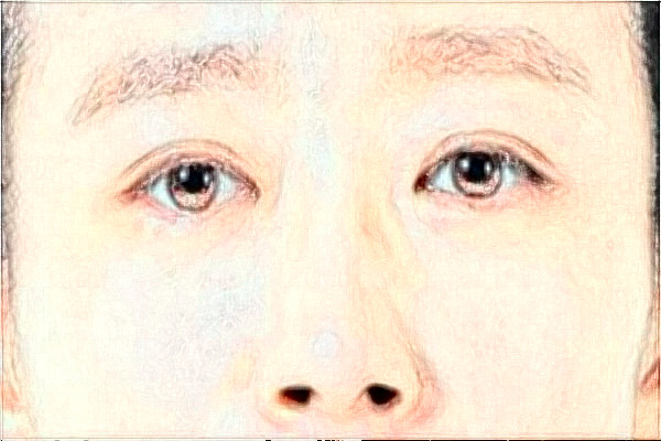 大連新華醫(yī)院近視手術誰做的好?醫(yī)生推薦