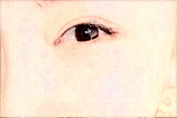 大連新華醫(yī)院近視手術誰做的好?醫(yī)生推薦