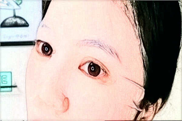 阜陽(yáng)市人民醫(yī)院全飛秒價(jià)目表(價(jià)格表)怎么樣