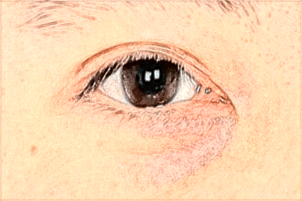 2024佛山市禪城區(qū)中心醫(yī)院熱瑪吉價(jià)格?熱瑪吉是什么