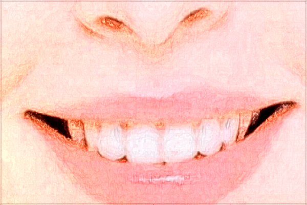 煙臺毓璜頂醫(yī)院拔牙可以嗎?2024拔牙多少錢一顆