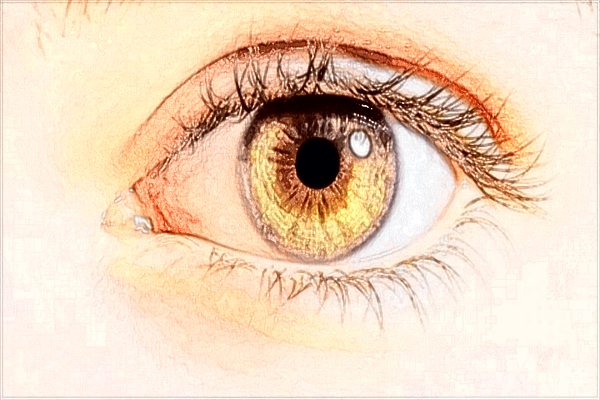 佛山市第二人民醫(yī)院飛秒做的好嗎?飛秒手術(shù)有風(fēng)險(xiǎn)嗎