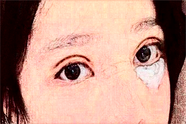 揚州市第一人民醫(yī)院半飛秒價格是多少?那個醫(yī)生好