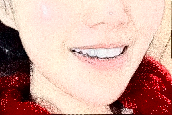 延邊醫(yī)院根管做的好嗎?誰做得好