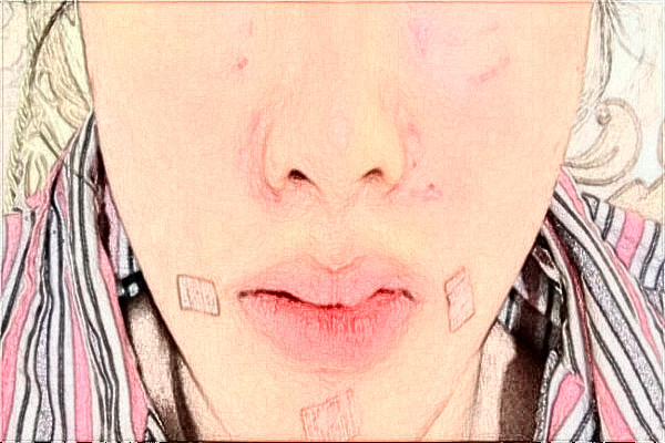 無錫市第一人民醫(yī)院激光脫毛做的怎么樣_誰做的比較好 