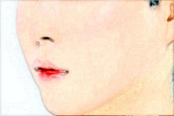 2024大慶市人民醫(yī)院面部提升怎么樣?全新案例分享