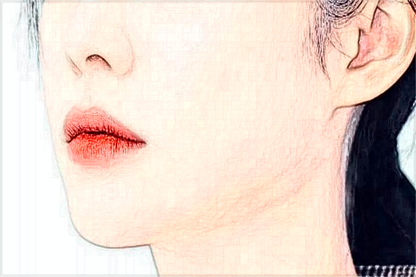 河北省人民醫(yī)院祛疤做的好嗎?真實案例反饋