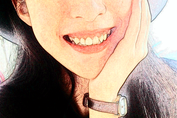 天津市第三中心醫(yī)院口腔科根管做的好嗎？根管整形日記