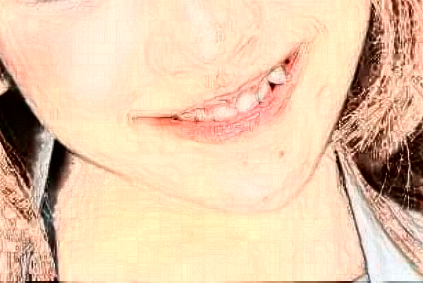 天津市第三中心醫(yī)院口腔科根管做的好嗎？根管整形日記