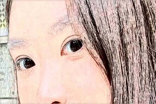 2024吉林大學(xué)第一醫(yī)院全飛秒做的好嗎?誰(shuí)做得好