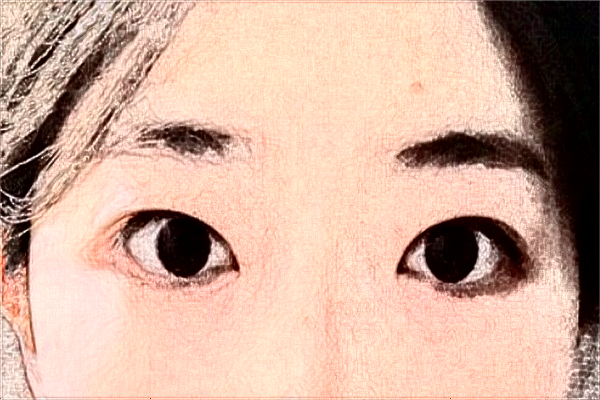 2024鎮(zhèn)江江濱醫(yī)院全飛秒怎么樣?哪個醫(yī)生做的比較好