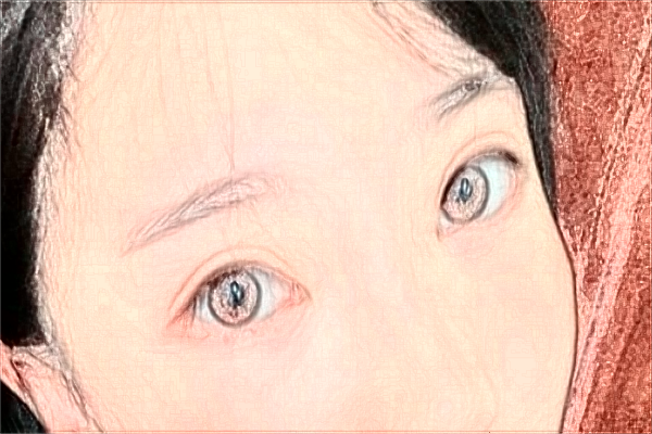 2024鎮(zhèn)江江濱醫(yī)院全飛秒怎么樣?哪個醫(yī)生做的比較好