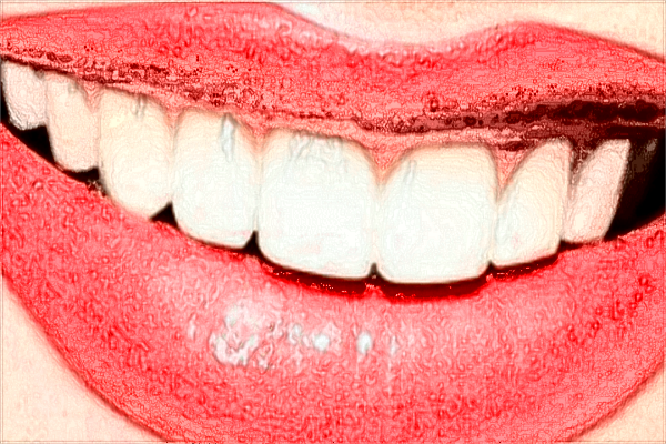 2024中山大學附屬口腔醫(yī)院拔智齒價格?拔智齒要多久恢復(fù)