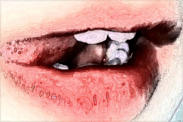 2024蘭州大學(xué)第二醫(yī)院割雙眼皮費(fèi)用?雙眼皮埋線(xiàn)好還是割好