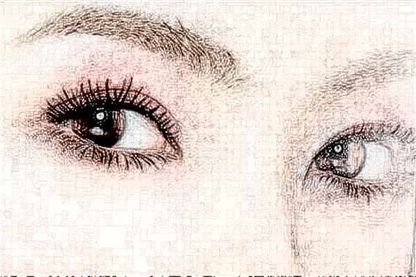 2024佛山市第二人民醫(yī)院飛秒近視手術(shù)價格?貴嗎?