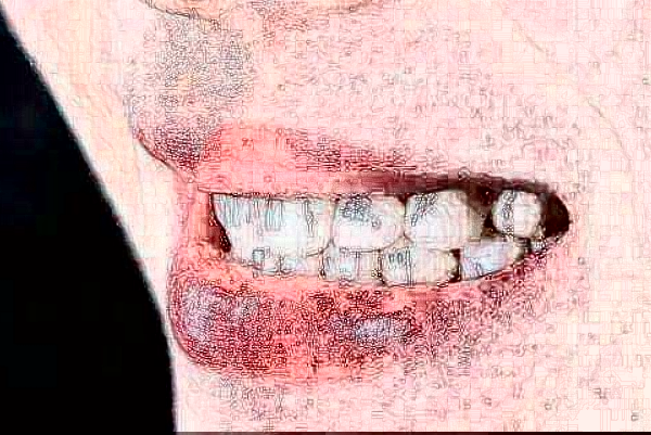 溫州醫(yī)學(xué)院附屬第二醫(yī)院口腔科烤瓷牙做的怎么樣_誰做的比較好