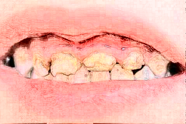 無(wú)錫市第一人民醫(yī)院口腔科鑲牙怎么樣_醫(yī)生名單推薦