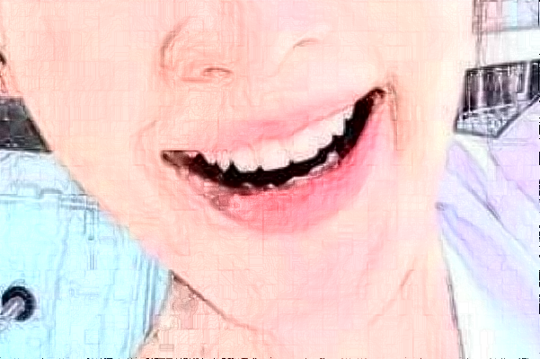 大連大學(xué)附屬新華醫(yī)院正畸做的好嗎?誰做得好