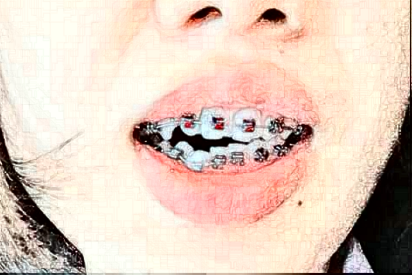 延邊醫(yī)院正畸做的好不好?醫(yī)生排名