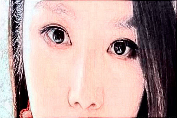 揚州市第一人民醫(yī)院割雙眼皮技術(shù)好嗎?醫(yī)生介紹