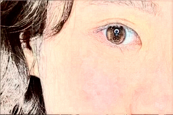 揚州市第一人民醫(yī)院割雙眼皮技術(shù)好嗎?醫(yī)生介紹